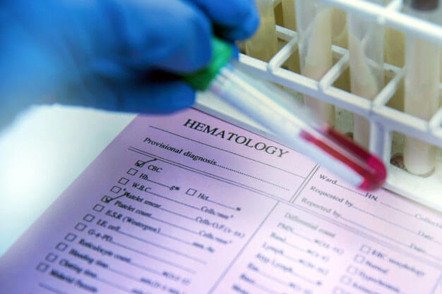Outsourced laboratory work